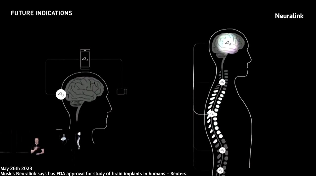 Elon Musk | "Elon Musk's Neuralink Has FDA Approval for Study of Brain Implants In Humans." (Reuters 5/16/2023) Why Do Yuval Noah Harari, Musk, Klaus Schwab, & The Chinese Communist All Agree On Brain-Computer Interfaces?