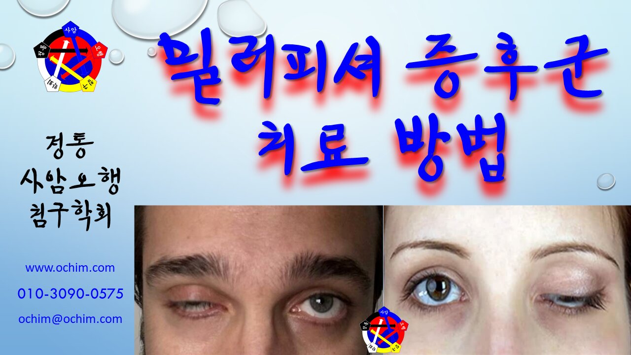 사암침법 - 밀러피셔 증후군 치료 방법 - 비과학적 양의학 110