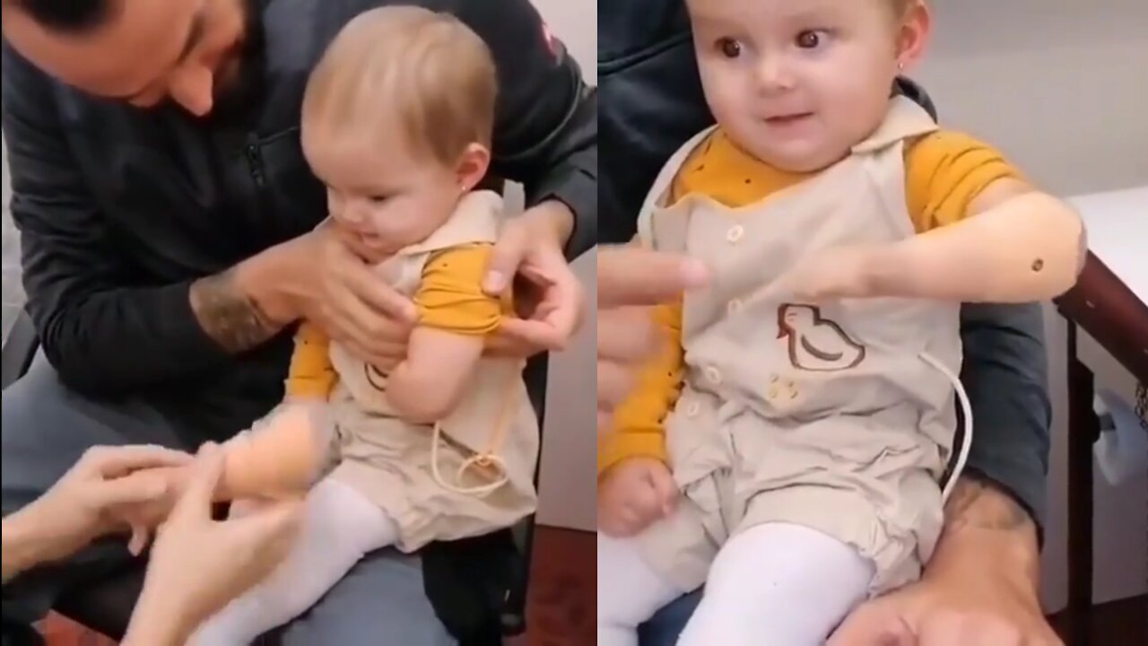 Baby Attached Artificial Arm for the First Time