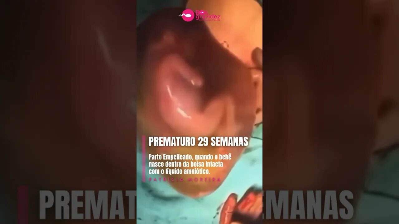 29 semanas de gestação