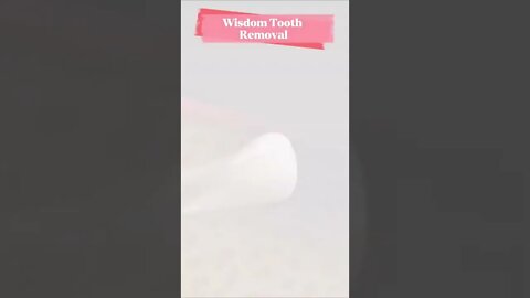 How many wisdom teeth have you pulledout? tiktok biopsychosociale