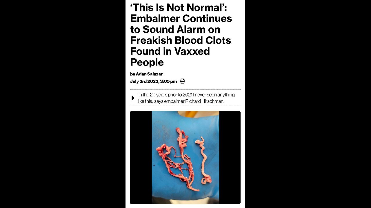 Blood clots after K19! Cancer is parasites! CO2 is harmless!