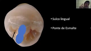 Anatomia de pré-molares inferiores