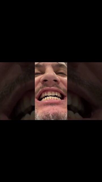 Teeth Cleaning Before And After