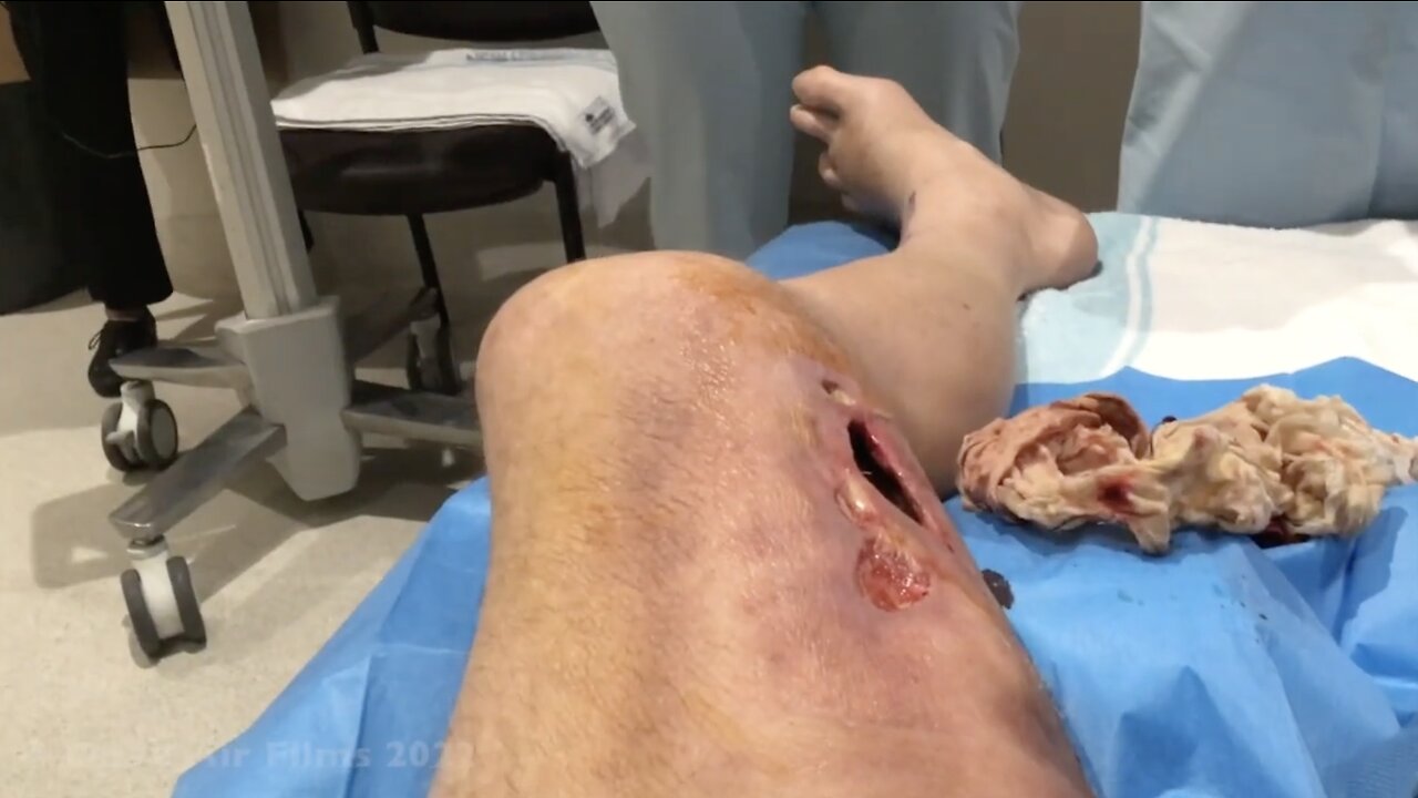 A HOLE IN ONE......LEG!!