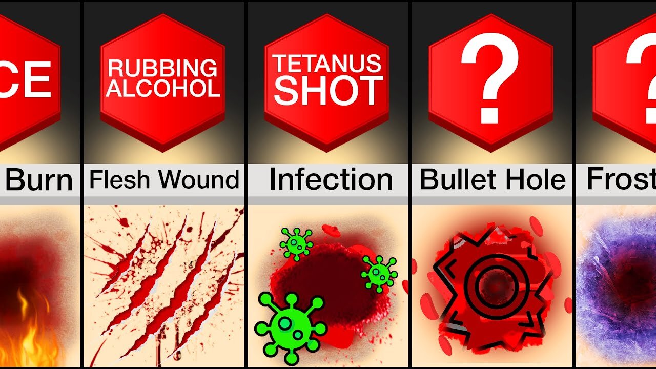 Comparison: Most Dangerous Injuries And How To Survive Them