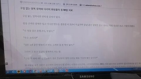 구김없는 양복 유머와 다리미 화상흉터침 Bt침 치료