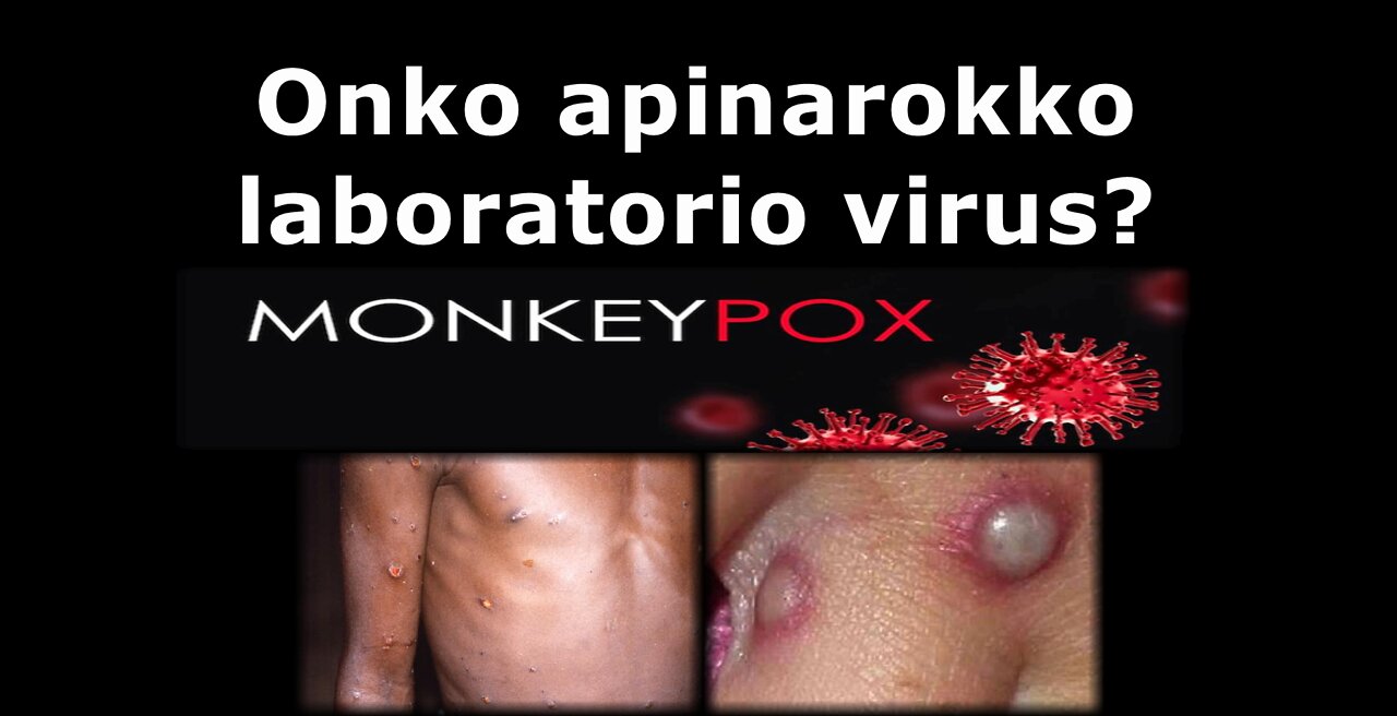 Onko apinarokko laboratorio virus?