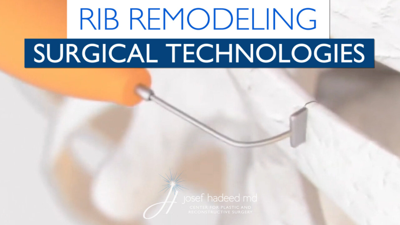 Rib Remodeling Technologies