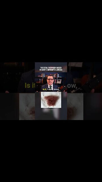 Harry, what hair implant? lol