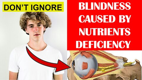 This Is How Nutrients Deficiency Caused Blindness