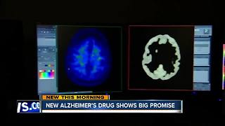 New Alzheimer's drug shows big promise
