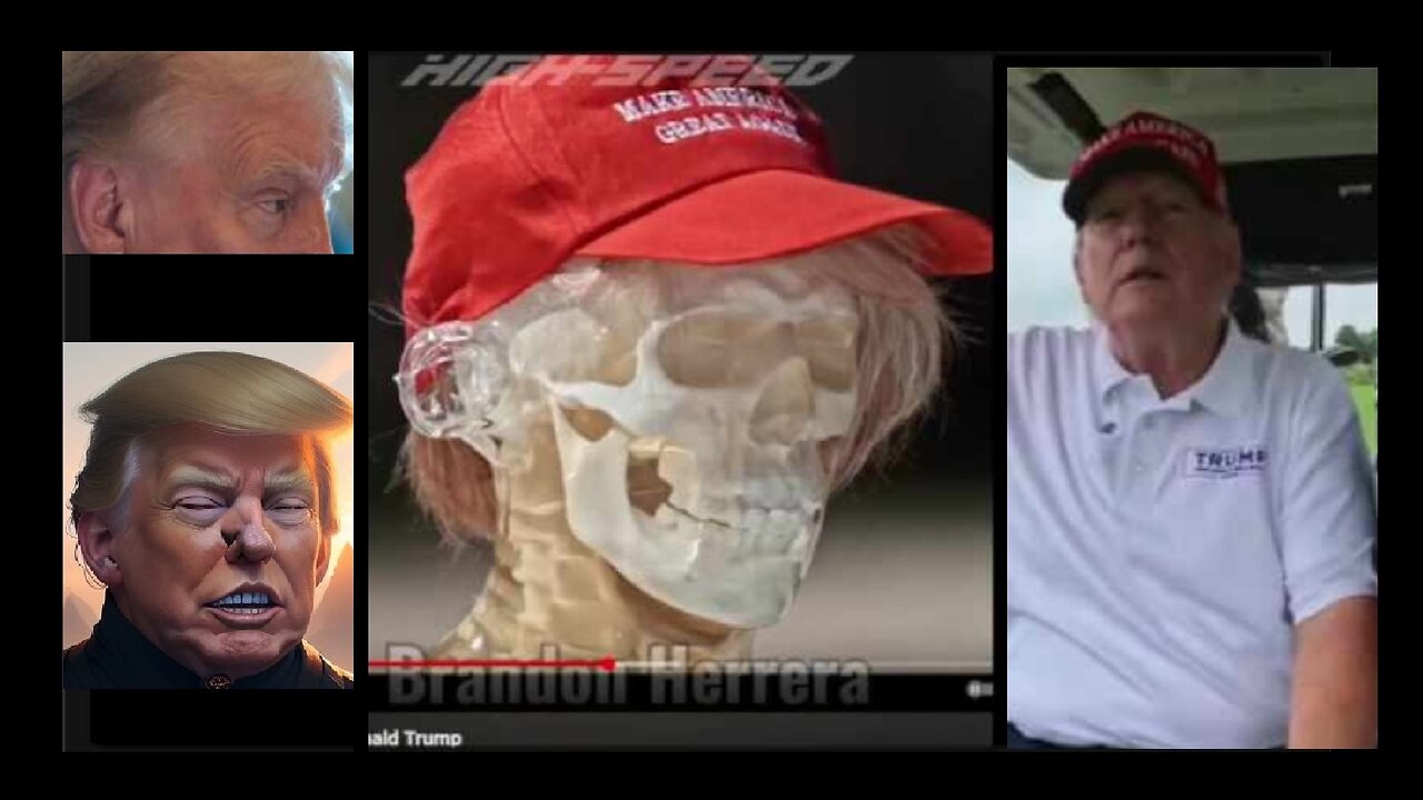 He Just Has The Best Ears , The Strongest Ears - 7/26/2024 - Harold And Susie