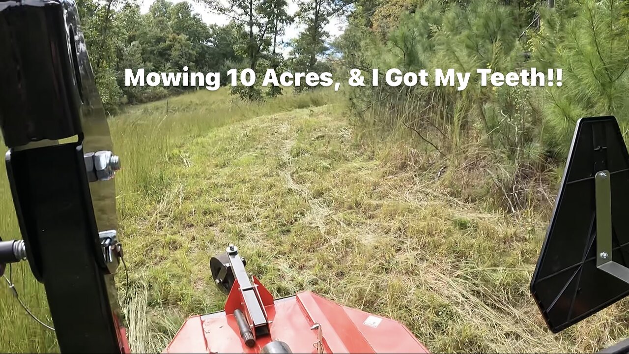 Mowing !0 Acres & Got My Teeth!