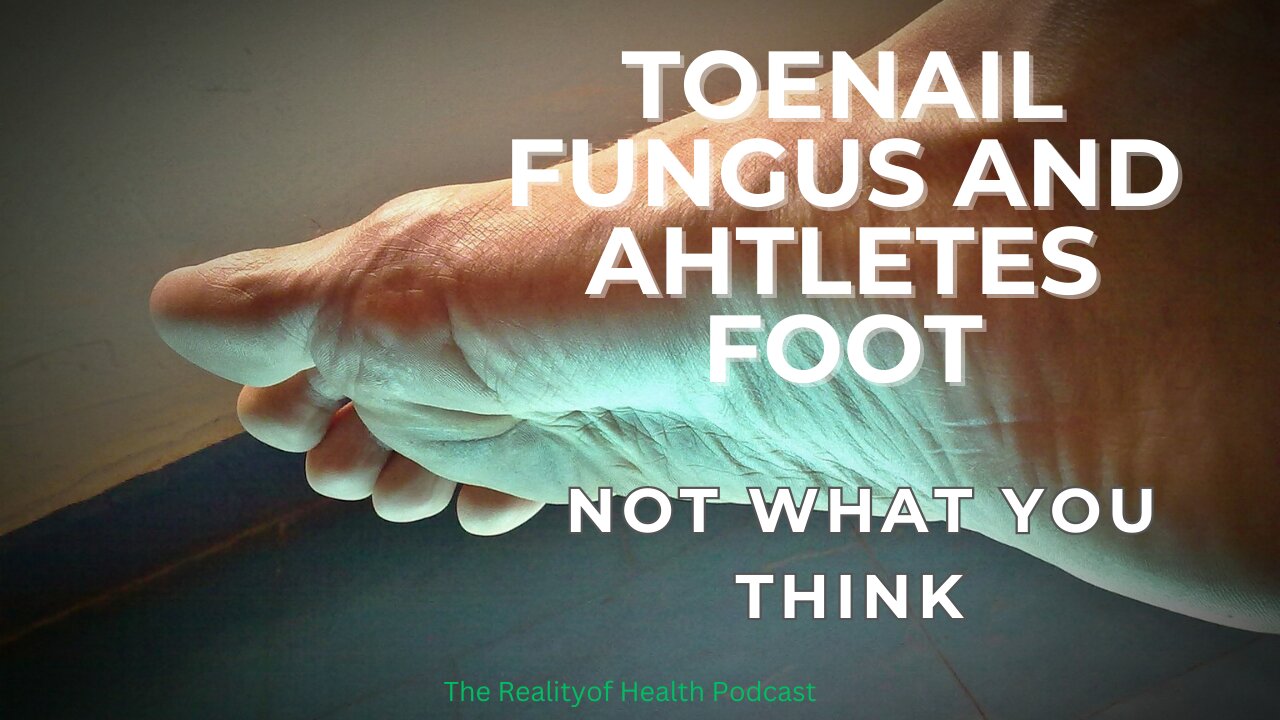 Toenail Fungus and Athletes Foot