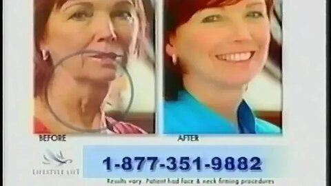 "Lifestyle Lift Cheap Facelift Lost Commercial" (2010) (Lost Media)
