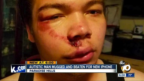 Autistic man mugged and beaten for iPhone