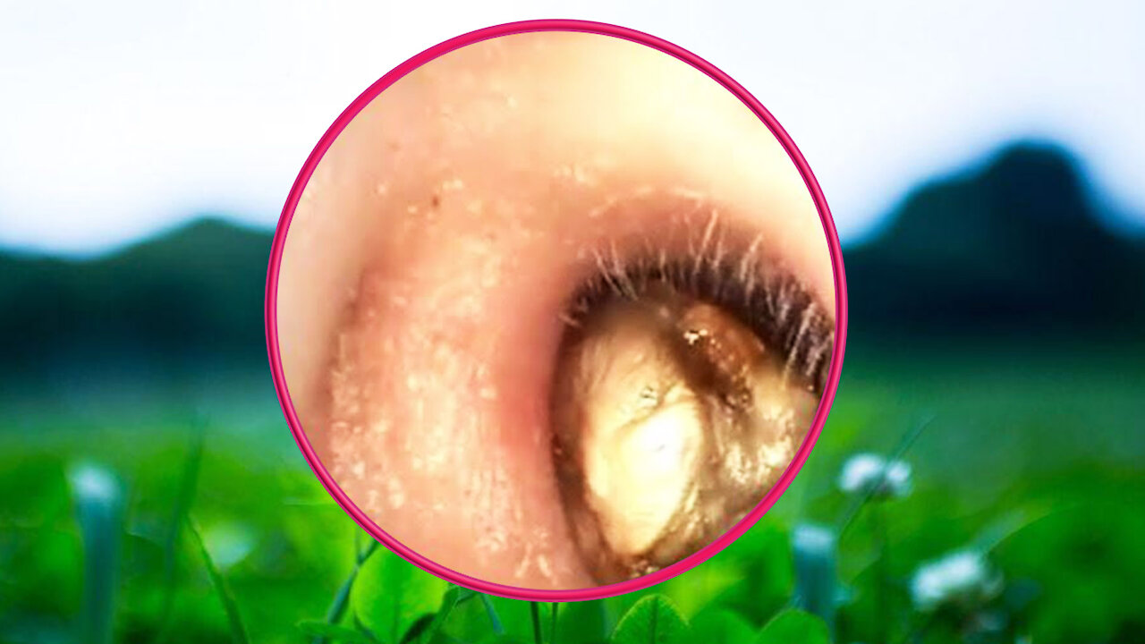 Earwax Removal With Clam Relaxing Music #57