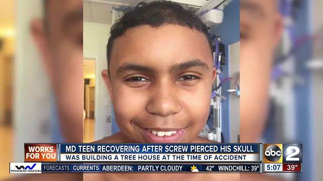 MD TEEN RECOVERING AFTER SCREW PIERCED HIS SKULL