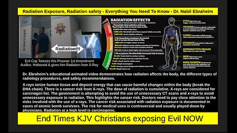 Radiation Exposure, Radiation safety - Everything You Need To Know - Dr. Nabil Ebraheim