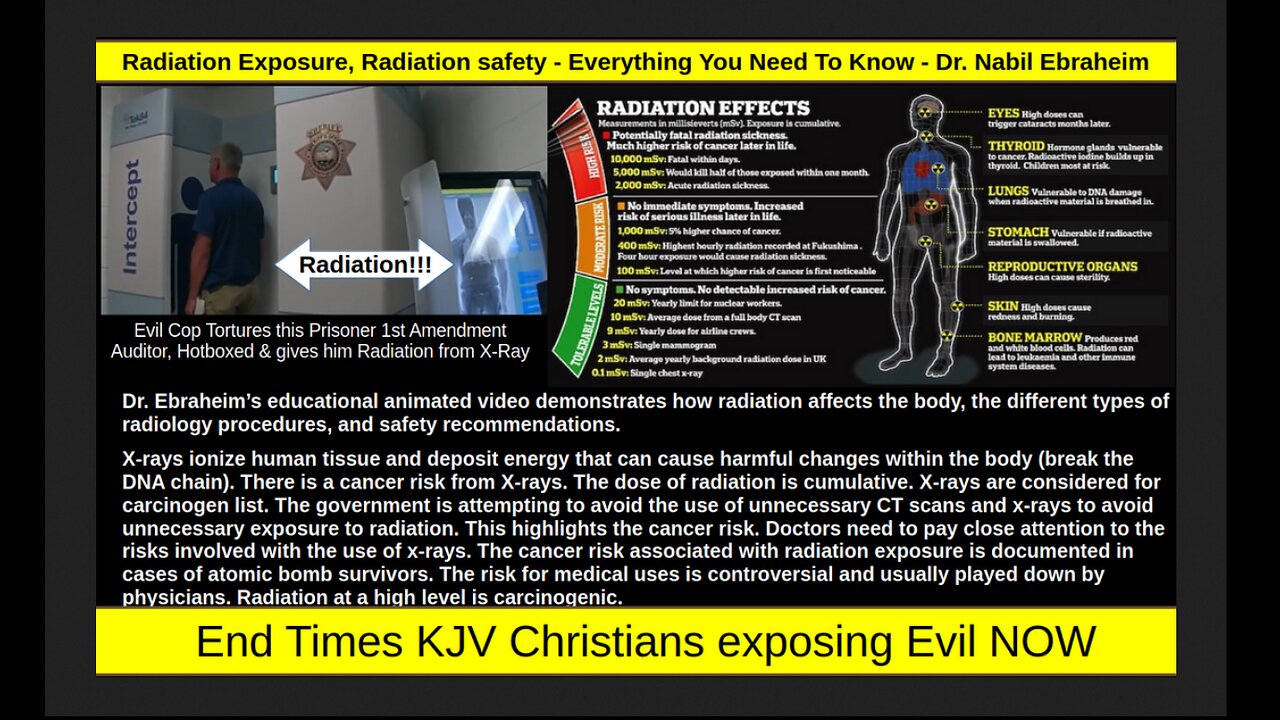 Radiation Exposure, Radiation safety - Everything You Need To Know - Dr. Nabil Ebraheim