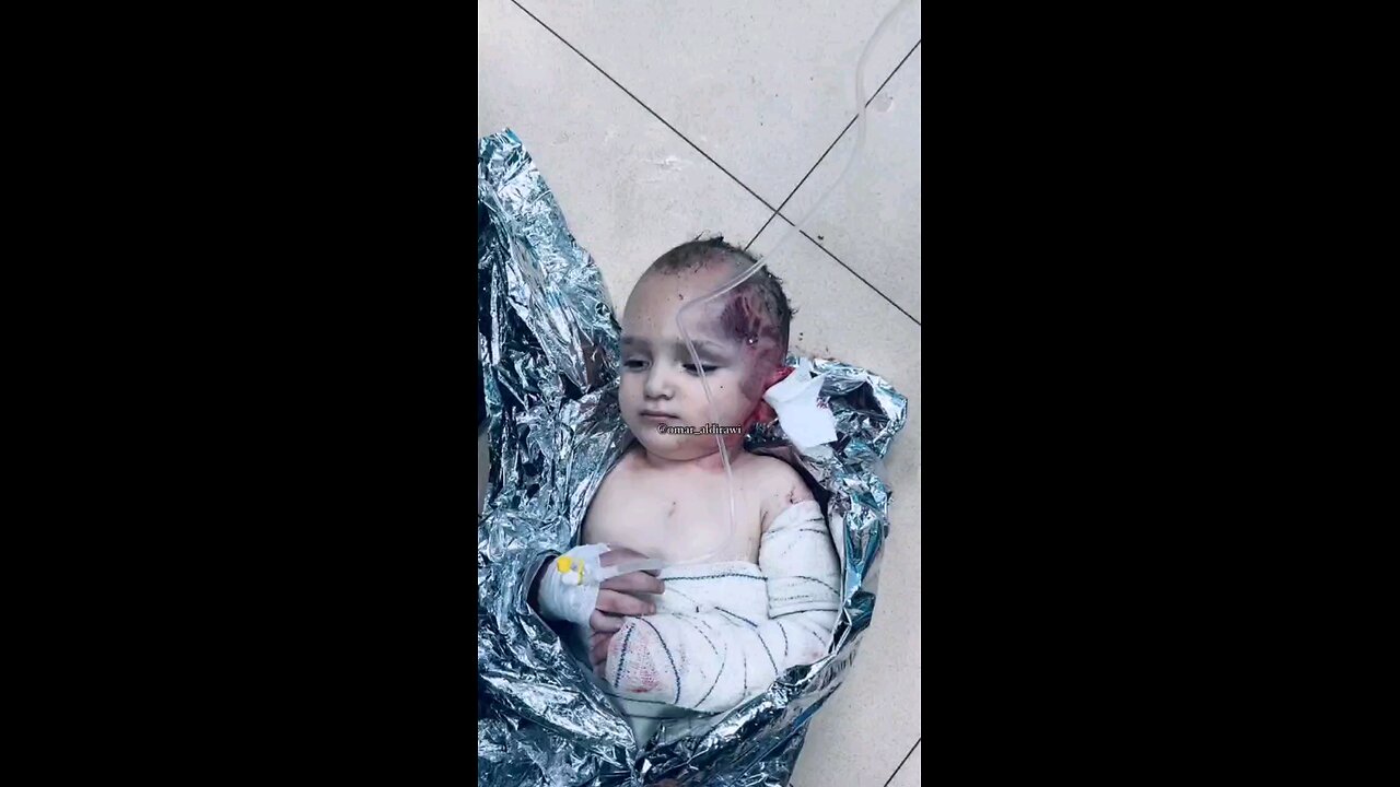 رضيع يرتجف بعد إصابته بقصف الاحتلال على قطاع غزة.