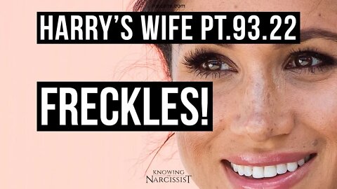 Harry´s Wife 93.22 Freckles! (Meghan Markle)