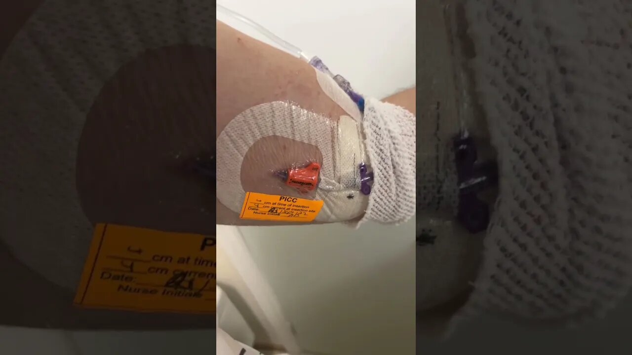 Painful PICC Line dressing change