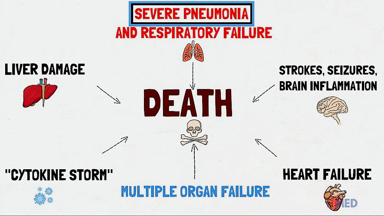 2020 Seasonal Influenza led to Obama's 2020 Pneumonia Pandemic via Antibiotic Stewardship Programs