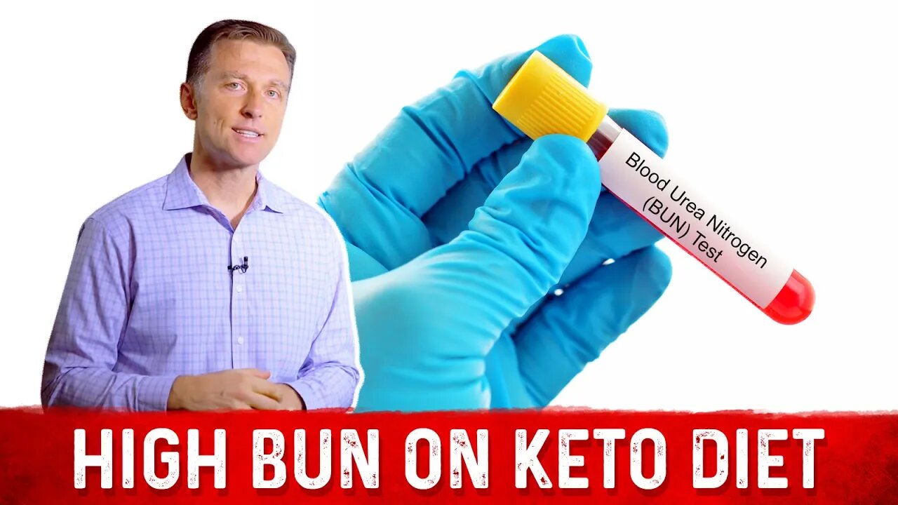 High Levels of BUN (Blood Urea Nitrogen) on a Ketogenic Diet – Dr. Berg