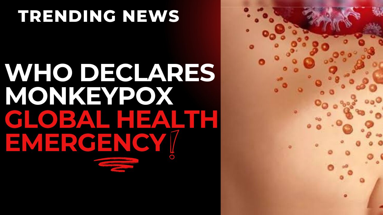 WHO Declares Monkeypox a "Global Health Emergency"!