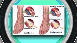 Neuropathy Relief // Front Range Medical Center