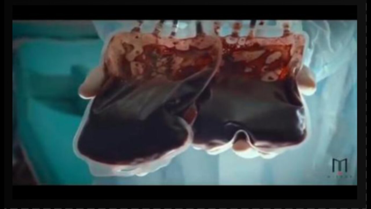 VAXXED Blood - The Issue of Transfusions from the Vaxxed! I don't want it. Do you?
