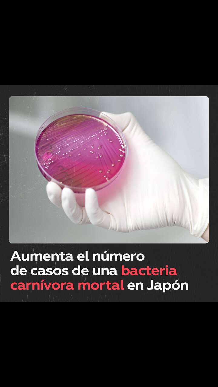 Bacteria capaz de matar a una persona en solo 2 días afecta a Japón