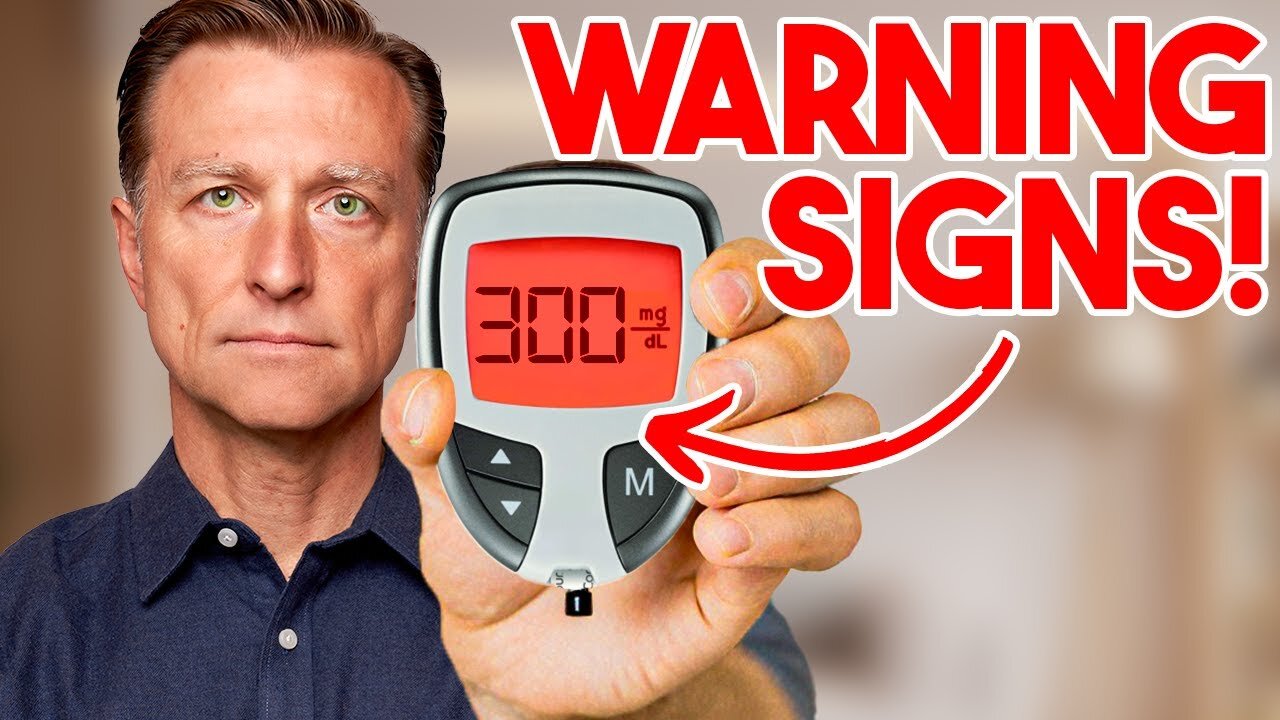 Dr Berg : 7 Alarming Signs Your Blood Sugar Is Too High