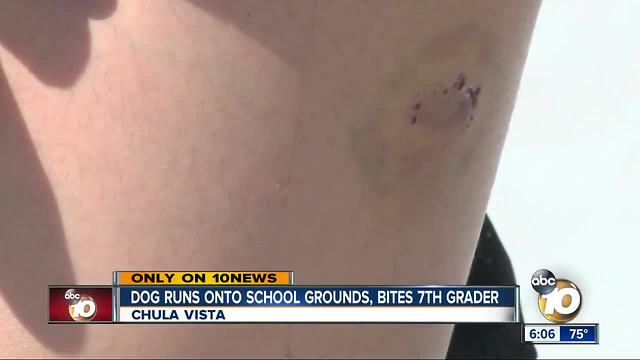 Dog runs onto school grounds, bites 7th grader