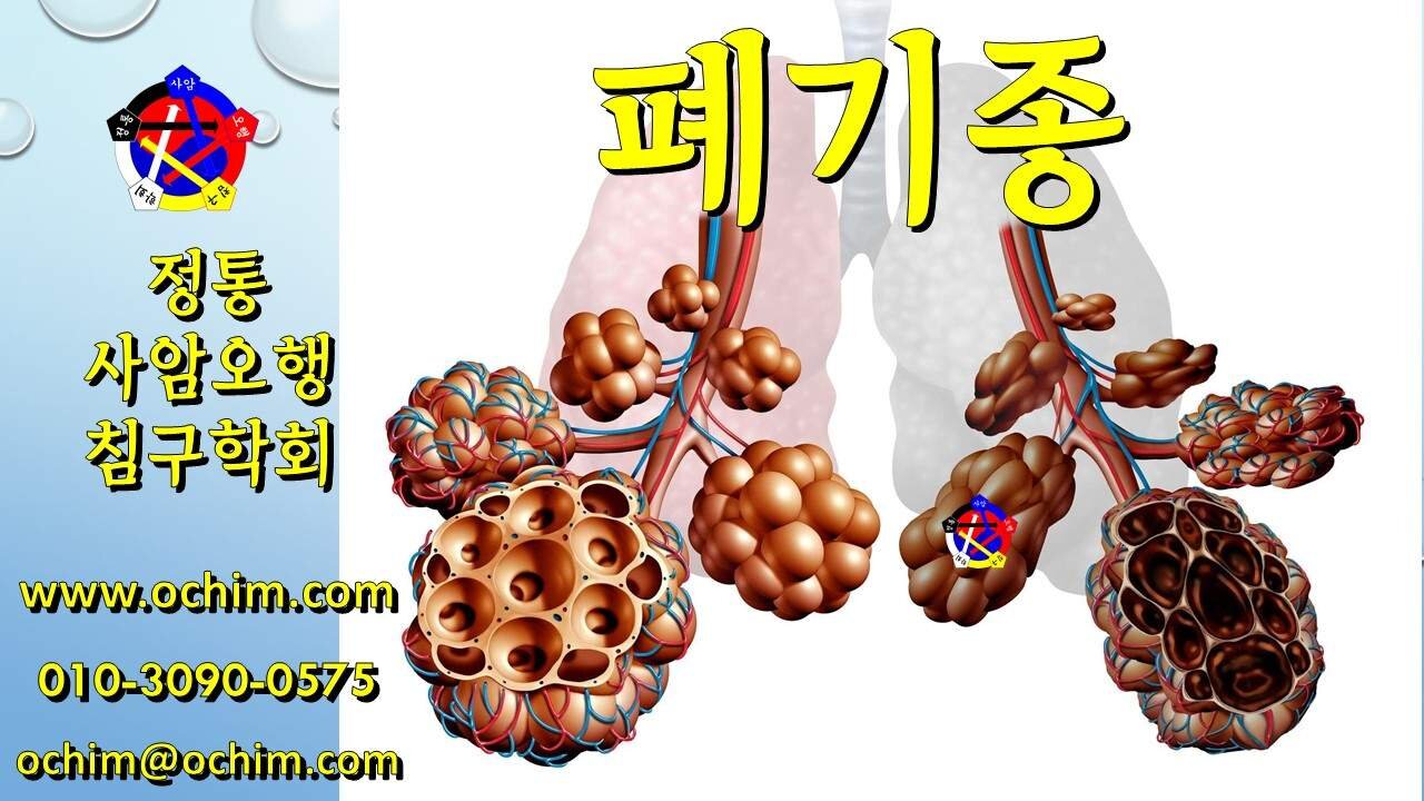 퍠기종 원인과 치료 - 사암오행침, 사암침법, 오행침, 정통사암침