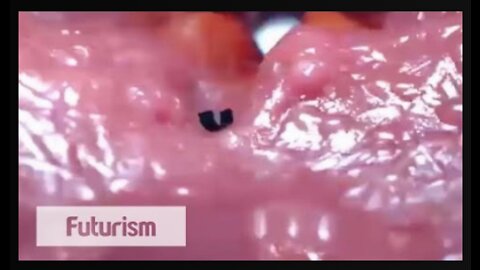 A Tiny Robot that Works Inside the Human Body!