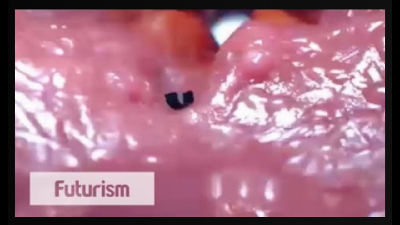 A Tiny Robot that Works Inside the Human Body!