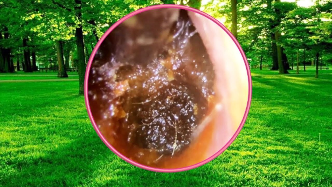 Ear Cleaning with Relaxing Music #14