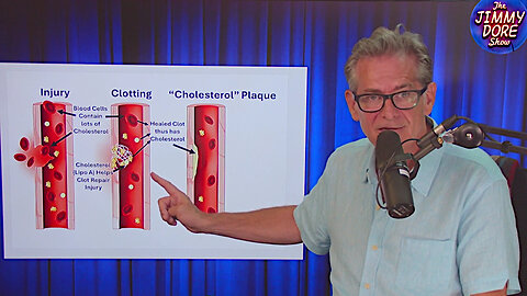 Bombshell: The Great Cholesterol Scam! – Jimmy Dore (Language Warning)