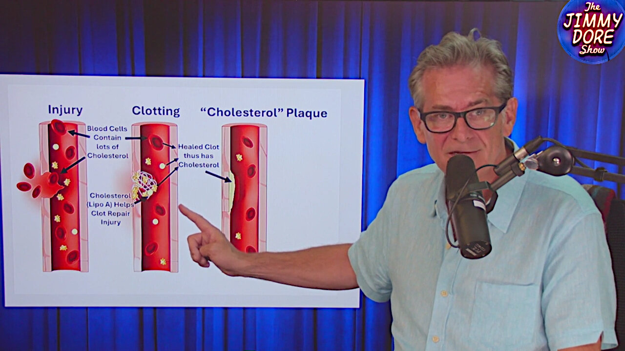 Bombshell: The Great Cholesterol Scam! – Jimmy Dore (Language Warning)