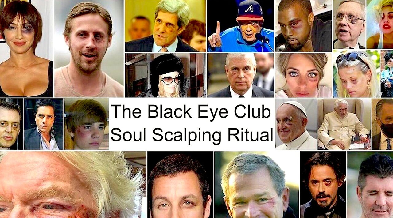 The Black Eye Club