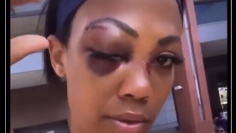 GRAPHIC: Olympic Medalist Kim Glass Reveals She Was Brutally Beaten by a Homeless Man in L.A.