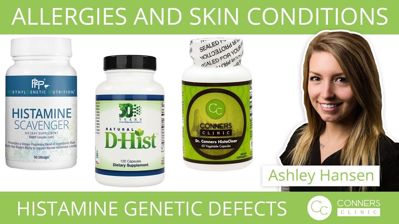 Allergies and Skin Conditions | Histamine Gene Defects | Conners Clinic