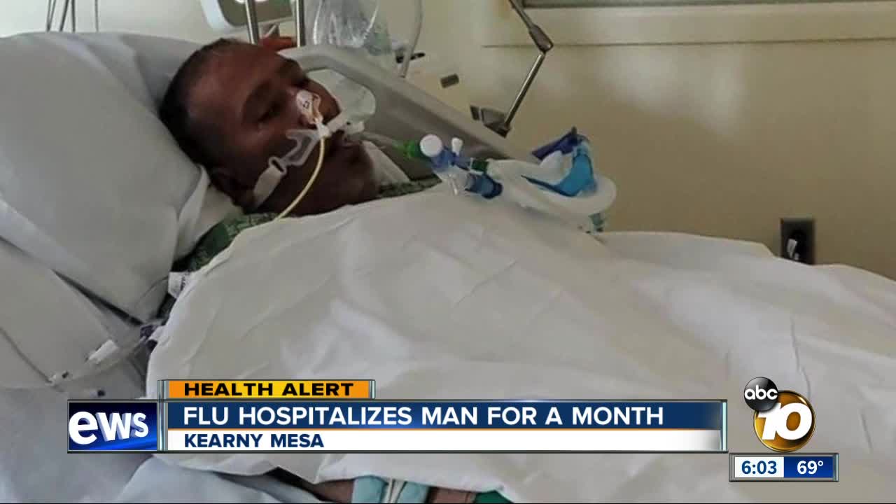 Flu hospitalizes San Diego man for a month