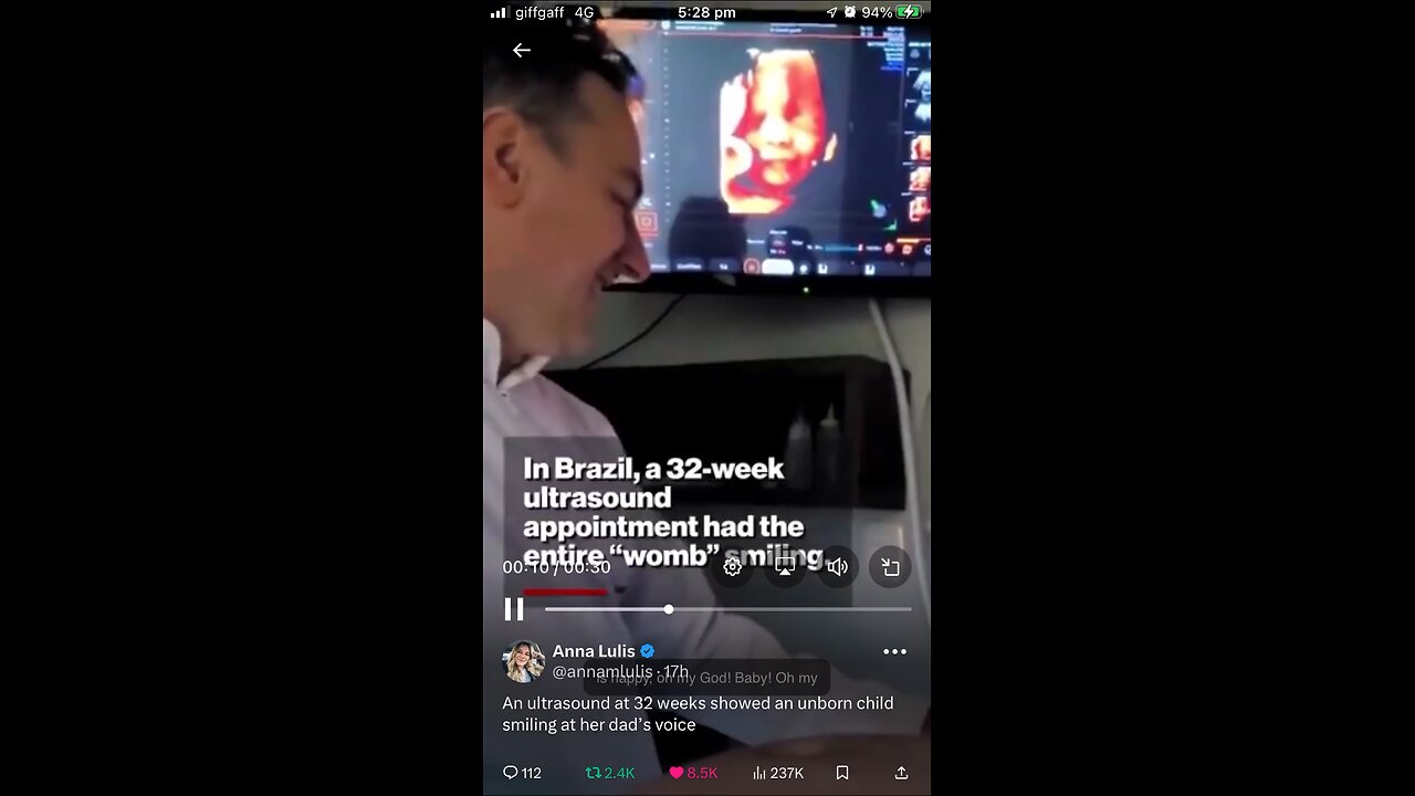 Unborn baby smiling when hears dads voice : scan