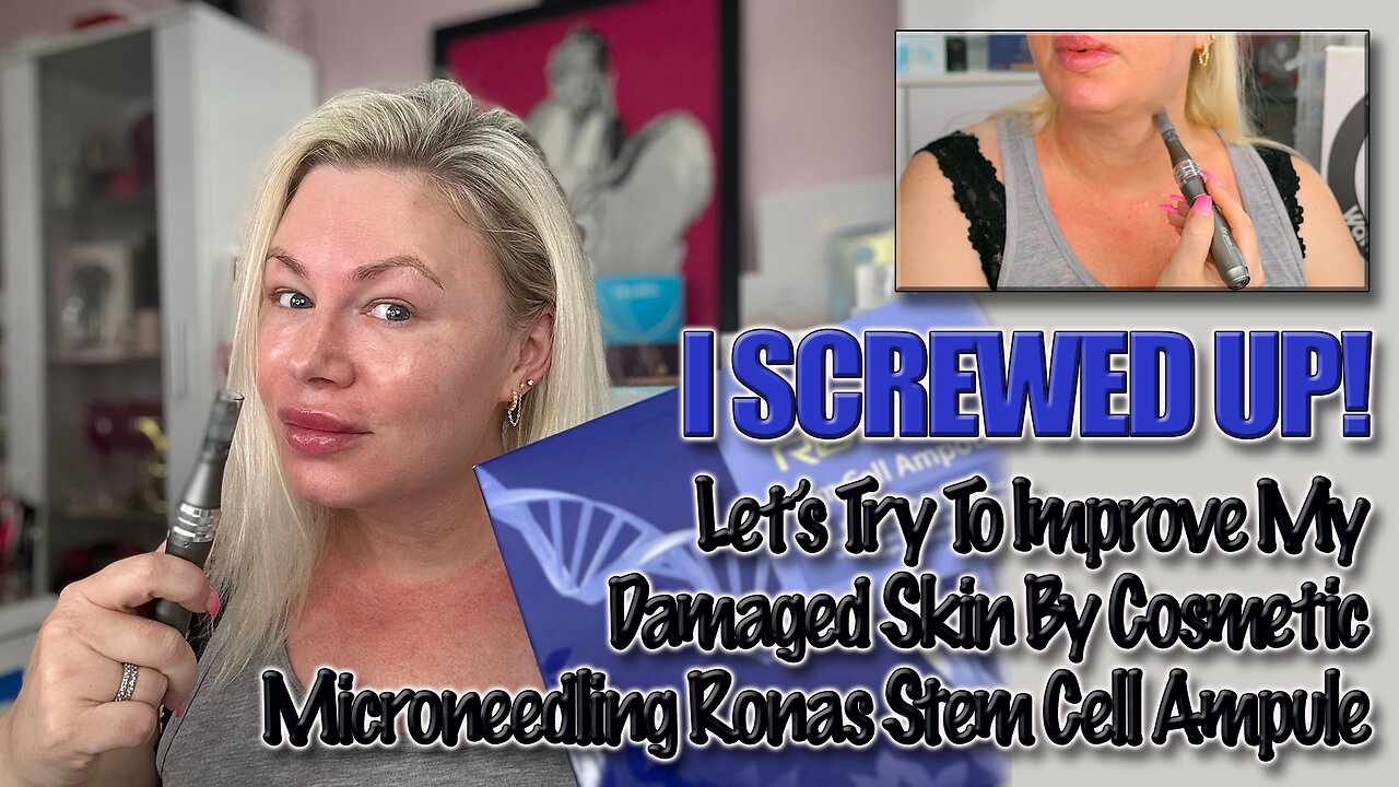 I Screwed Up! Let's Try to Microneedle Ronas Stem Cells to Heal! AceCosm.com Code Jessica10 Saves