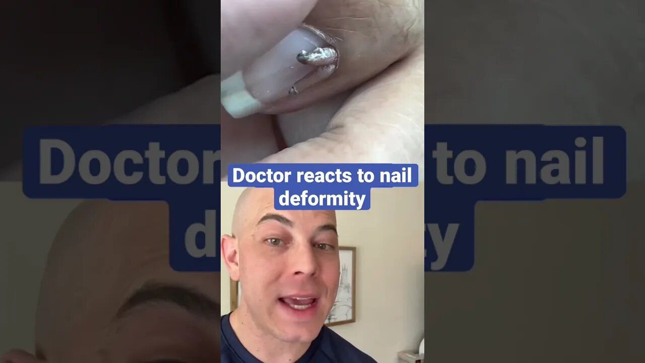 Doctor reacts to gnarly nail deformity!