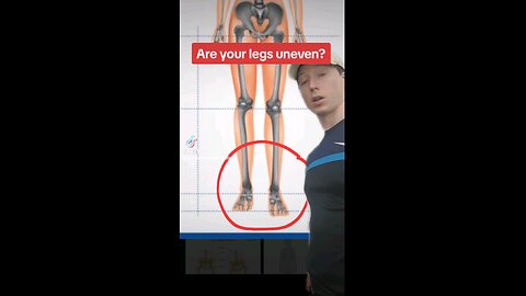 Do your feet do this?